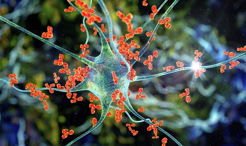  Pacientes con trastorno del espectro de neuromielitis óptica cuentan con nueva terapia que reduce el riesgo de recaídas en un 98.6%