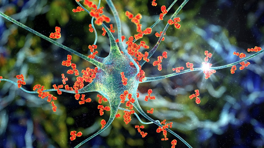 Pacientes con trastorno del espectro de neuromielitis óptica cuentan con nueva terapia que reduce el riesgo de recaídas en un 98.6%