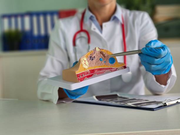  Mitad de las pacientes con cáncer de mama no presentaban factores de riesgo