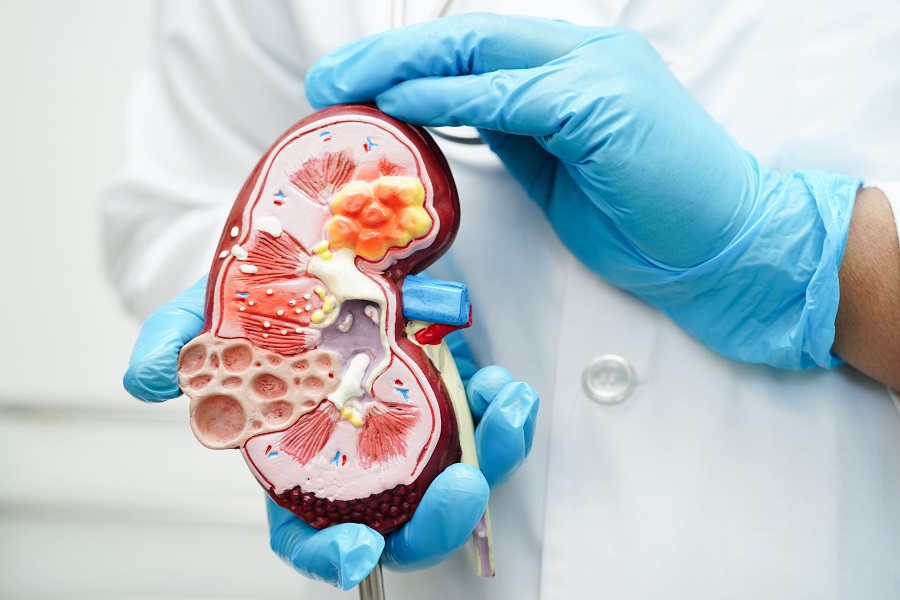 Presentan nuevo tratamiento para pacientes con hiperkalemia